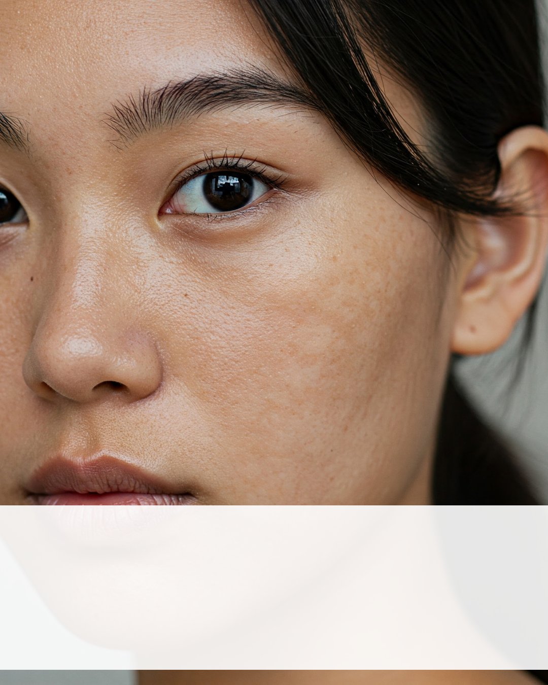Uneven Skin & Pigmentation